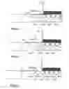 Fig. 07 - Method and device for feeding sheets one by one from a pile of sheets