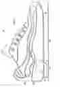 Fig. 02 - Heeling apparatus and method