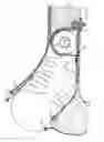 Fig. 11 - Thorax airbag device, seat provided with the same and method for activating said thorax airbag