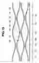Fig. 10 - Capacitive ultrasonic transducer, production method thereof, and capacitive ultrasonic probe