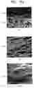 Fig. 08 - Field emission type backlight unit and method of manufacturing upper panel thereof