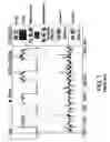 Fig. 08 - Regulator for eliminating noises generated by automotive power generator
