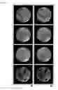 Fig. 04 - Method of reconstructing parallel magnetic resonance image using radial K-space trajectory, apparatus thereof, and computer readable recording medium recorded with program for executing the method