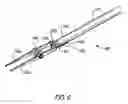 Fig. 06 - Dual tip probe