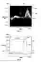 Fig. 05 - Method and apparatus for automatically adjusting spectral doppler gain