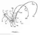 Fig. 04 - APPARATUS FOR HANDS-FREE SUPPORT OF A DEVICE IN FRONT OF A USER'S BODY