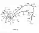 Fig. 11 - APPARATUS FOR HANDS-FREE SUPPORT OF A DEVICE IN FRONT OF A USER'S BODY