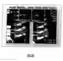 Fig. 17 - Stereo-measurement borescope with 3-D viewing