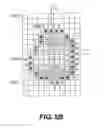 Fig. 11 - Real-time target confirmation for radiation therapy