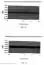 Fig. 12 - High sensitivity noise immune stethoscope