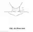 Fig. 03 - Three-dimensional skin-contact microphone device