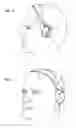 Fig. 04 - Audio headphone