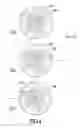 Fig. 04 - Accelerometer utilizing image-based movement tracking