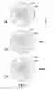 Fig. 07 - Accelerometer utilizing image-based movement tracking