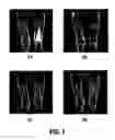 Fig. 02 - System and method for the joint evaluation of multi phase MR marrow images