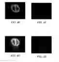 Fig. 06 - Method and systems for diffusion tensor imaging