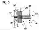 Fig. 04 - Adjustable fastening surface device with releasable thread form