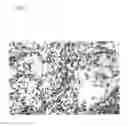 Fig. 02 - METHOD FOR MODULATING HLA CLASS II TUMOR CELL SURFACE EXPRESSION WITH A CYTOKINE MIXTURE