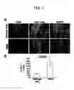 Fig. 02 - Formulation to improve survival of transplanted cells