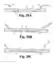 Fig. 22 - Vascular occlusion methods, systems and devices