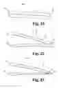 Fig. 34 - Vascular occlusion methods, systems and devices
