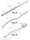 Fig. 40 - Vascular occlusion methods, systems and devices