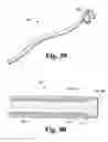 Fig. 41 - Vascular occlusion methods, systems and devices