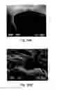 Fig. 41 - Osteogenic proteins