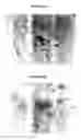 Fig. 06 - Composition and method for issue repair and regeneration