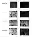 Fig. 09 - Composition and method for issue repair and regeneration