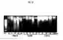 Fig. 09 - Anticancer or antiviral composition