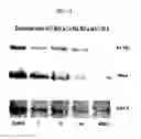 Fig. 12 - Anticancer or antiviral composition