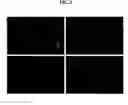 Fig. 04 - Extracts of houttuynia cordata and rubus coreanus and their composition for preventing and treating allergic diseases