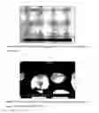 Fig. 05 - Composition and method for making a proppant