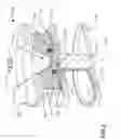 Fig. 03 - Ion source with removable anode assembly