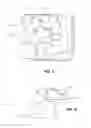 Fig. 04 - SELF-LIGATING ORTHODONTIC BRACKET WITH MID-UNDERCUT