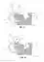 Fig. 08 - SELF-LIGATING ORTHODONTIC BRACKET WITH MID-UNDERCUT