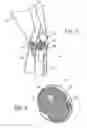 Fig. 03 - Joint replica models and methods of using same for testing medical devices
