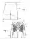 Fig. 04 - Joint replica models and methods of using same for testing medical devices
