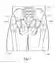 Fig. 05 - Joint replica models and methods of using same for testing medical devices