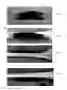 Fig. 08 - Joint replica models and methods of using same for testing medical devices