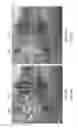 Fig. 22 - COGNITIVE TRAINING USING VISUAL STIMULI