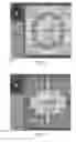 Fig. 07 - COGNITIVE TRAINING USING GUIDED EYE MOVEMENTS