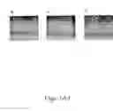 Fig. 04 - Methods for inhibiting adipogenesis and for treating type 2 diabetes