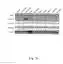 Fig. 06 - Methods for inhibiting adipogenesis and for treating type 2 diabetes