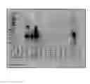 Fig. 01 - METHODS OF IN VITRO PROPAGATION AND DETECTION OF INFECTIOUS PRION