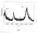 Fig. 06 - METHOD AND APPARATUS FOR MASS SPECTROMETRIC IMMUNOASSAY ANALYSIS OF SPECIFIC BIOLOGICAL FLUID PROTEINS