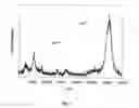 Fig. 05 - METHOD AND APPARATUS FOR MASS SPECTROMETRIC IMMUNOASSAY ANALYSIS OF SPECIFIC BIOLOGICAL FLUID PROTEINS