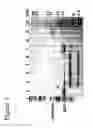 Fig. 02 - Method of determining chymase activity with secretory leukocyte protease inhibitor
