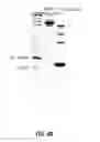 Fig. 07 - Use of GR2 proteins to modify cellulosic materials and to enhance enzymatic and chemical modification of cellulose
